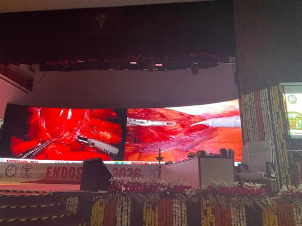 Robotic Surgery at AIIMS Surgical week 2026